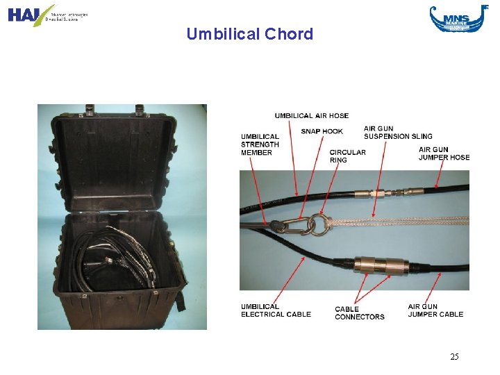 Umbilical Chord 25 