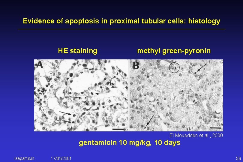 Evidence of apoptosis in proximal tubular cells: histology HE staining methyl green-pyronin El Mouedden