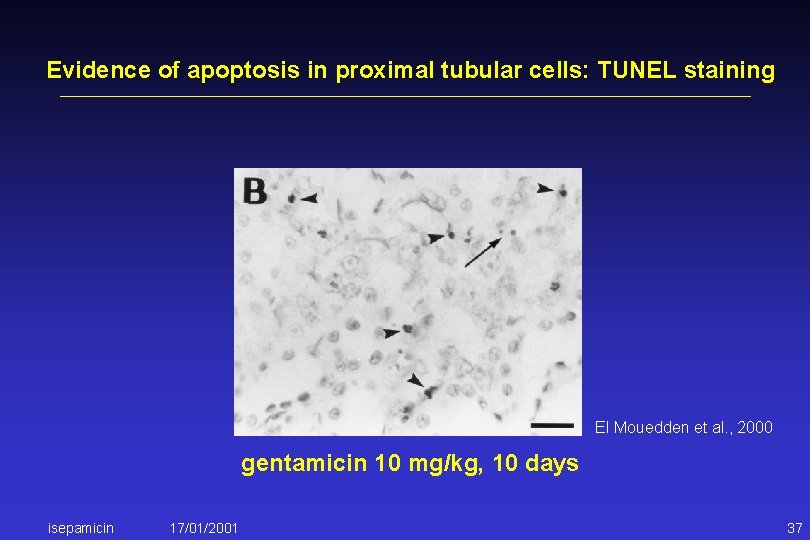 Evidence of apoptosis in proximal tubular cells: TUNEL staining El Mouedden et al. ,