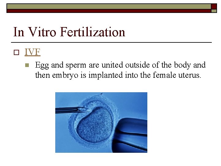 In Vitro Fertilization o IVF n Egg and sperm are united outside of the