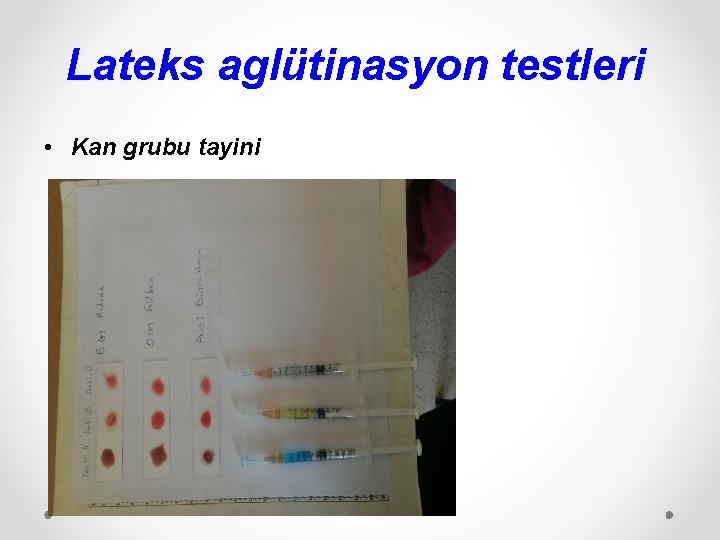 Lateks aglütinasyon testleri • Kan grubu tayini 