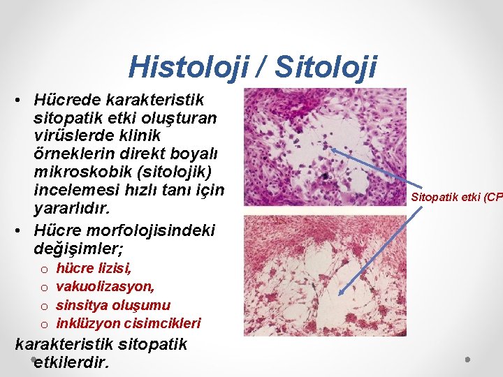Histoloji / Sitoloji • Hücrede karakteristik sitopatik etki oluşturan virüslerde klinik örneklerin direkt boyalı