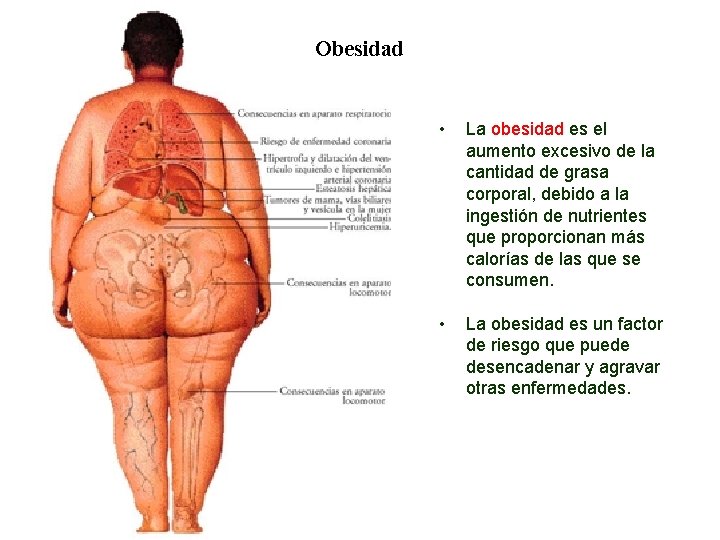 02 Obesidad • La obesidad es el aumento excesivo de la cantidad de grasa