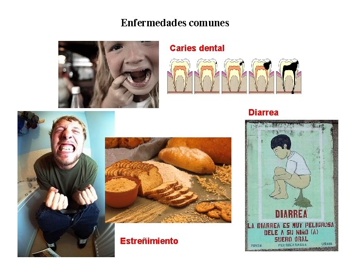 02 Enfermedades comunes Caries dental Diarrea Estreñimiento 