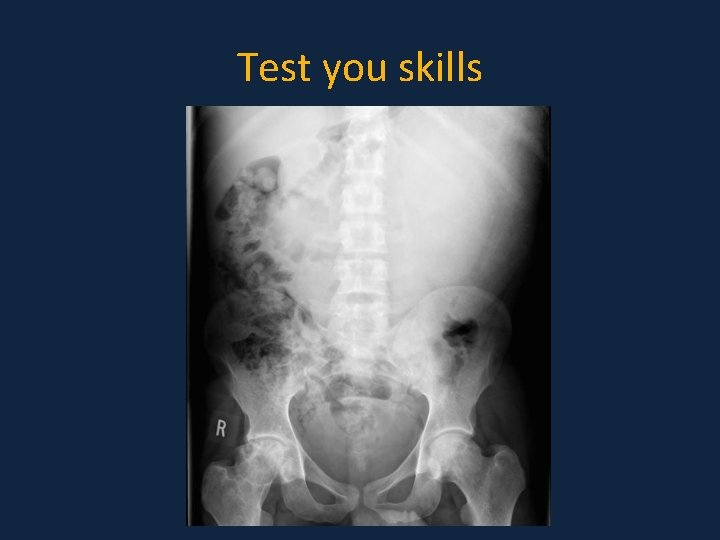 Test you skills Test you skills