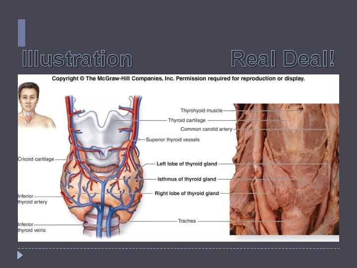 Illustration Real Deal! Illustration Real Deal!