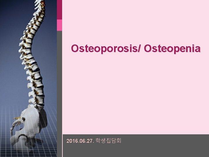 Osteoporosis/ Osteopenia 2016. 06. 27. 학생집담회 