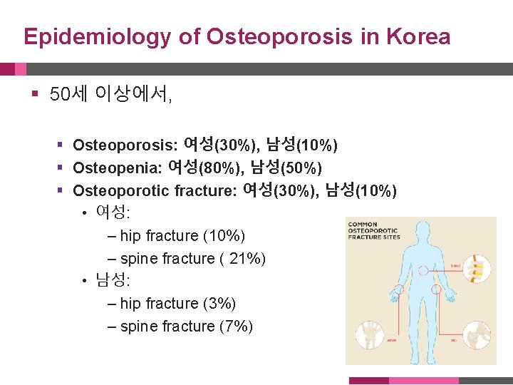 Epidemiology of Osteoporosis in Korea § 50세 이상에서, § Osteoporosis: 여성(30%), 남성(10%) § Osteopenia: