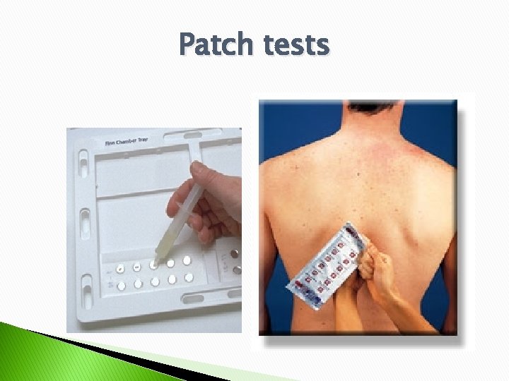 Patch tests 