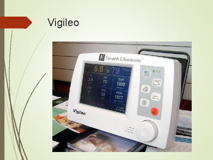 Vigileo Vigileo