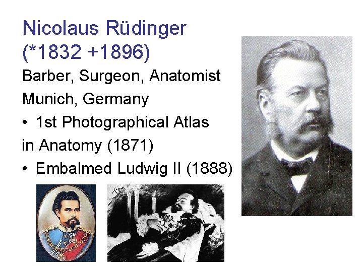 Nicolaus Rüdinger (*1832 +1896) Barber, Surgeon, Anatomist Munich, Germany • 1 st Photographical Atlas