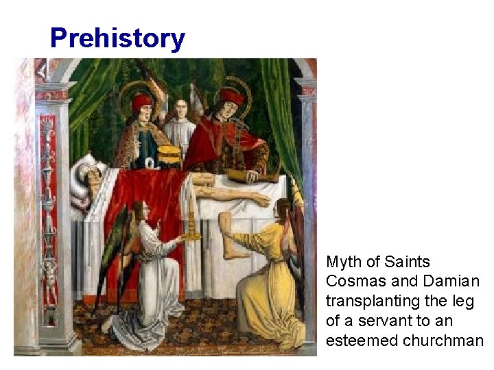 Prehistory Myth of Saints Cosmas and Damian transplanting the leg of a servant to