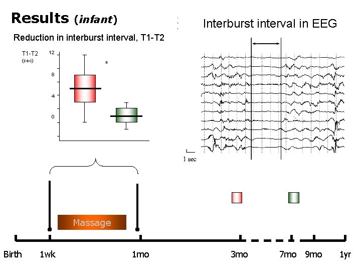 Results (infant) Interburst interval in EEG Reduction in interburst interval, T 1 -T 2