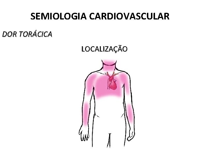 SEMIOLOGIA CARDIOVASCULAR DOR TORÁCICA LOCALIZAÇÃO 