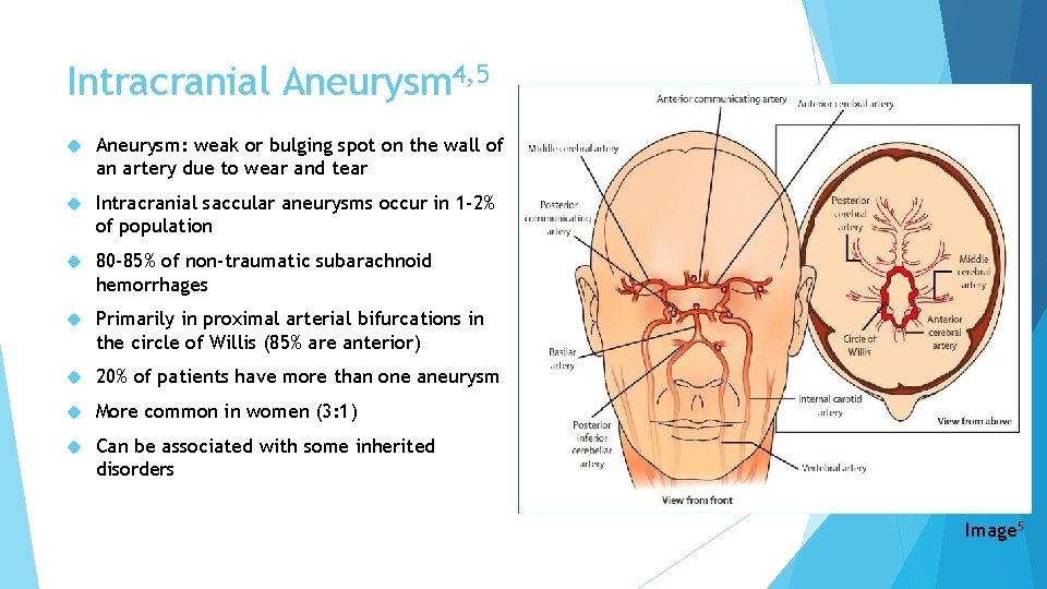 Intracranial Aneurysm 4, 5 Aneurysm: weak or bulging spot on the wall of an