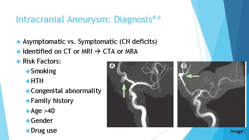 Intracranial Aneurysm: Diagnosis 4 -6 Asymptomatic vs. Symptomatic (CN deficits) Identified on CT or