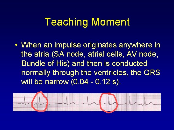 Teaching Moment • When an impulse originates anywhere in the atria (SA node, atrial
