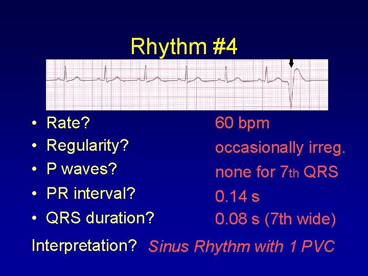 Rhythm #4 • • • Rate? Regularity? P waves? PR interval? QRS duration? 60