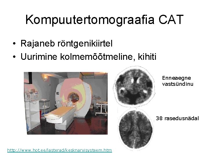 Kompuutertomograafia CAT • Rajaneb röntgenikiirtel • Uurimine kolmemõõtmeline, kihiti Enneaegne vastsündinu 38 rasedusnädal http: