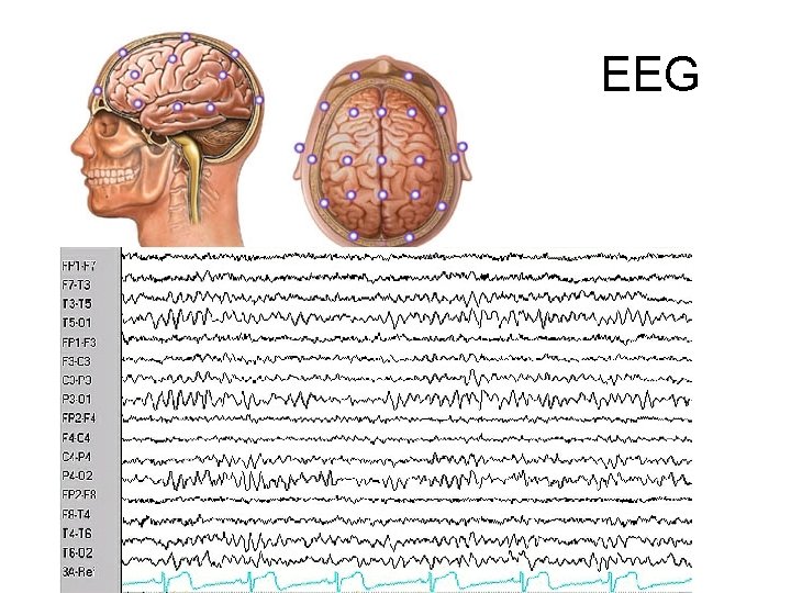 EEG 