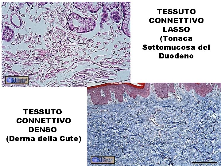 TESSUTO CONNETTIVO LASSO (Tonaca Sottomucosa del Duodeno TESSUTO CONNETTIVO DENSO (Derma della Cute) 