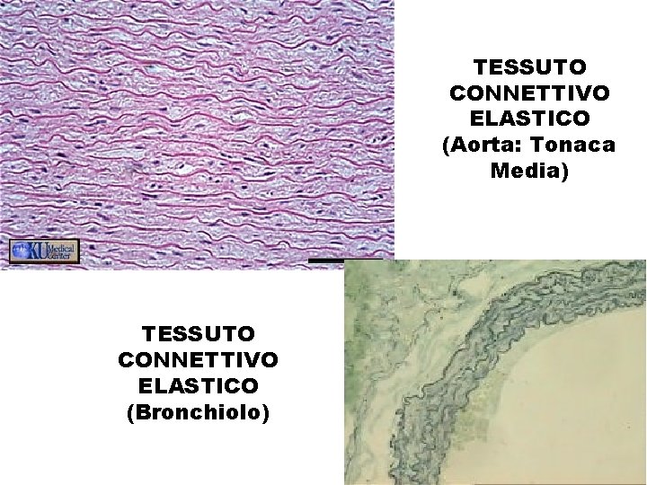 TESSUTO CONNETTIVO ELASTICO (Aorta: Tonaca Media) TESSUTO CONNETTIVO ELASTICO (Bronchiolo) 