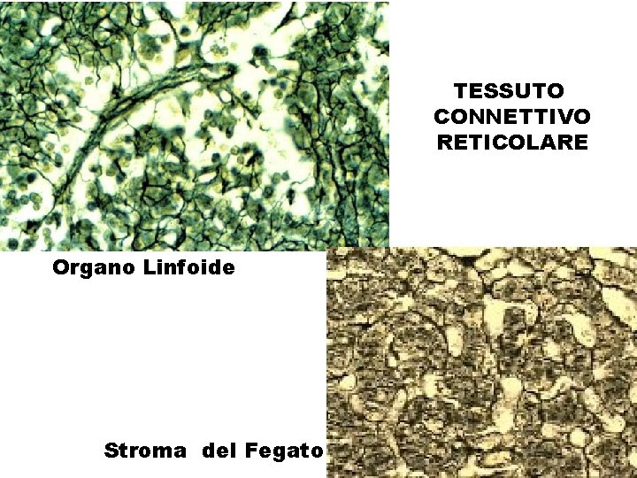 TESSUTO CONNETTIVO RETICOLARE Organo Linfoide Stroma del Fegato 