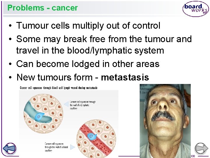 Problems - cancer • Tumour cells multiply out of control • Some may break