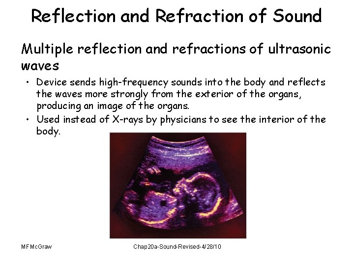 Reflection and Refraction of Sound Multiple reflection and refractions of ultrasonic waves • Device