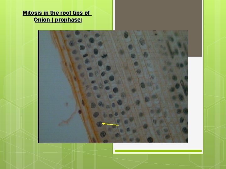 Mitosis in the root tips of Onion ( prophase) 
