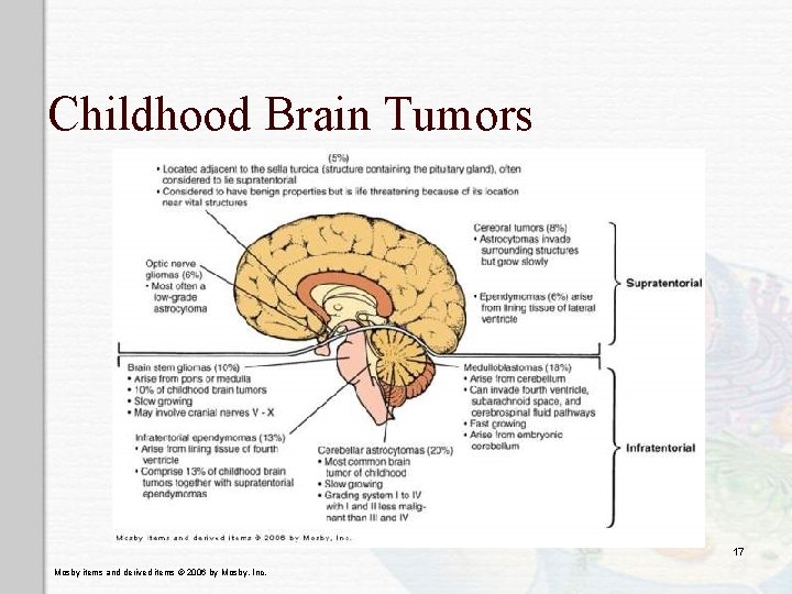 Childhood Brain Tumors 17 Mosby items and derived items © 2006 by Mosby, Inc.