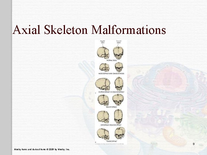 Axial Skeleton Malformations 9 Mosby items and derived items © 2006 by Mosby, Inc.