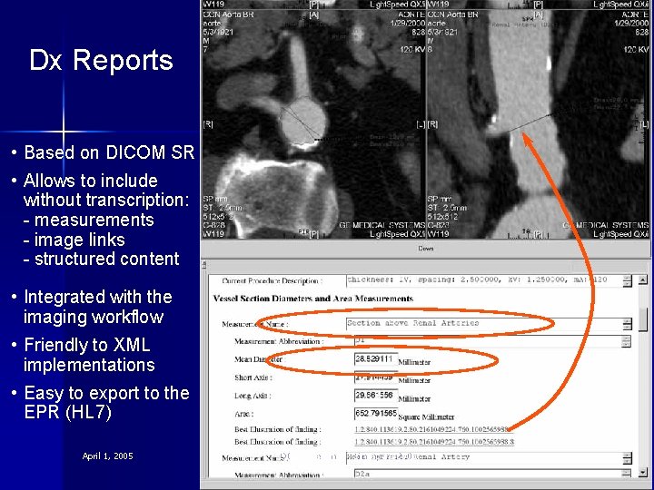Dx Reports • Based on DICOM SR • Allows to include without transcription: -
