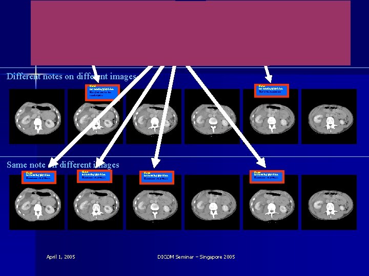 Note 2 Note 3 for referring physician for physician Here you can seereferring the