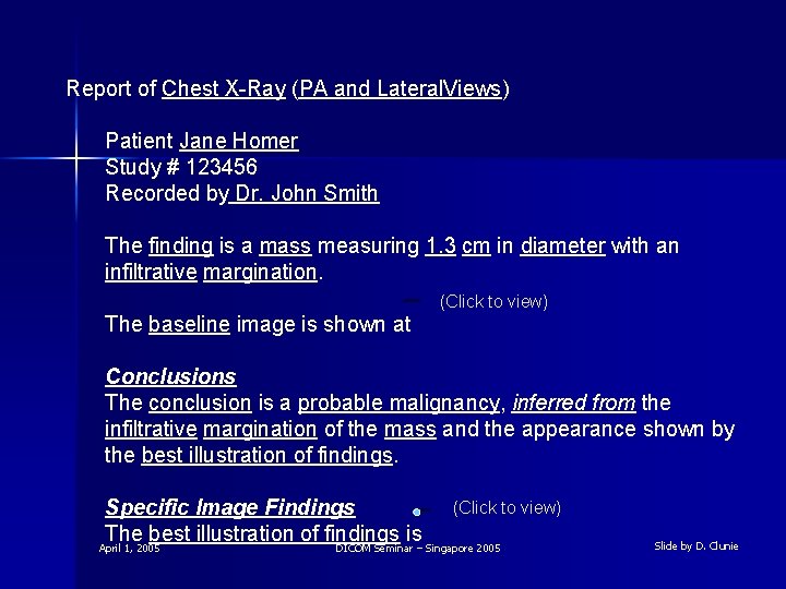 Report of Chest X-Ray (PA and Lateral. Views) Patient Jane Homer Study # 123456