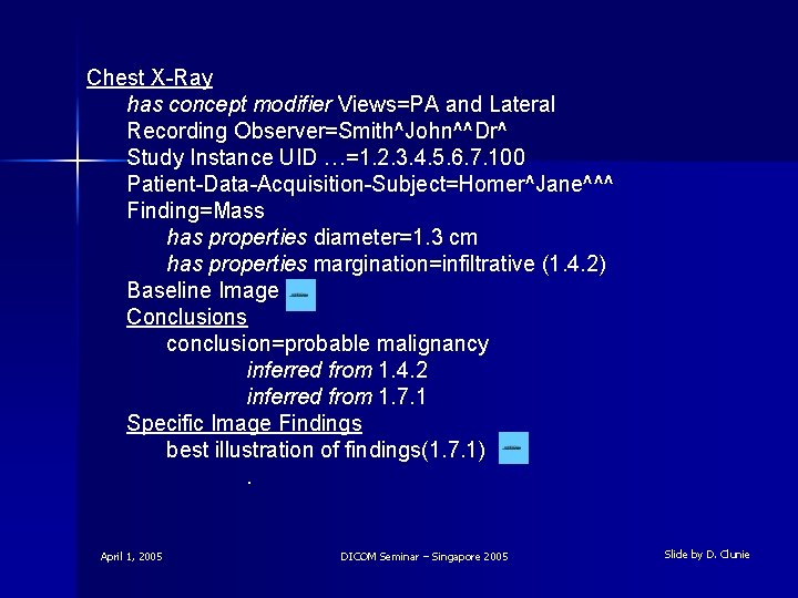 Chest X-Ray has concept modifier Views=PA and Lateral Recording Observer=Smith^John^^Dr^ Study Instance UID …=1.