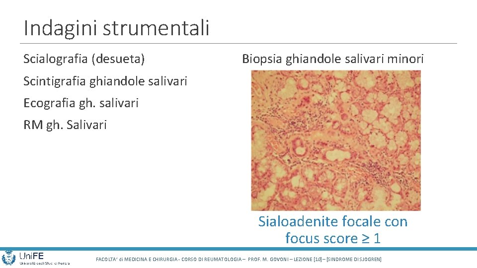 Indagini strumentali Scialografia (desueta) Biopsia ghiandole salivari minori Scintigrafia ghiandole salivari Ecografia gh. salivari