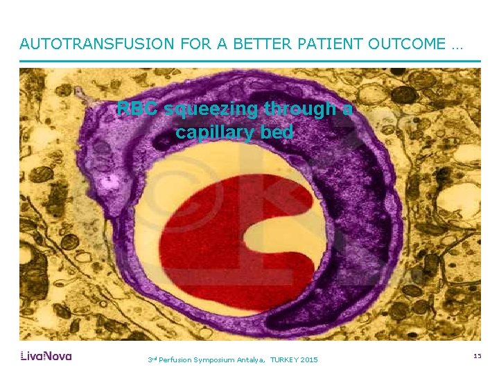 AUTOTRANSFUSION FOR A BETTER PATIENT OUTCOME … RBC squeezing through a capillary bed 3