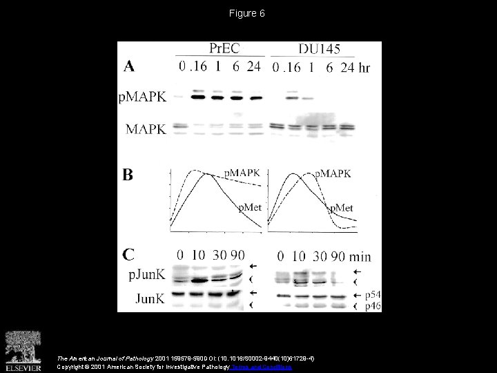 Normal and Malignant Prostate Epithelial Cells Differ in