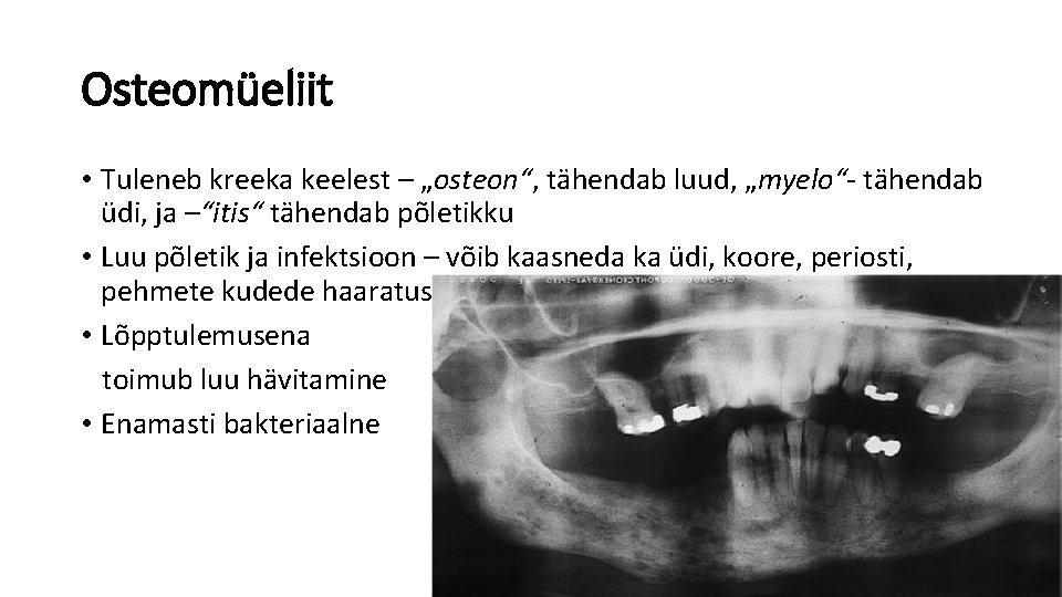 Osteomüeliit • Tuleneb kreeka keelest – „osteon“, tähendab luud, „myelo“- tähendab üdi, ja –“itis“