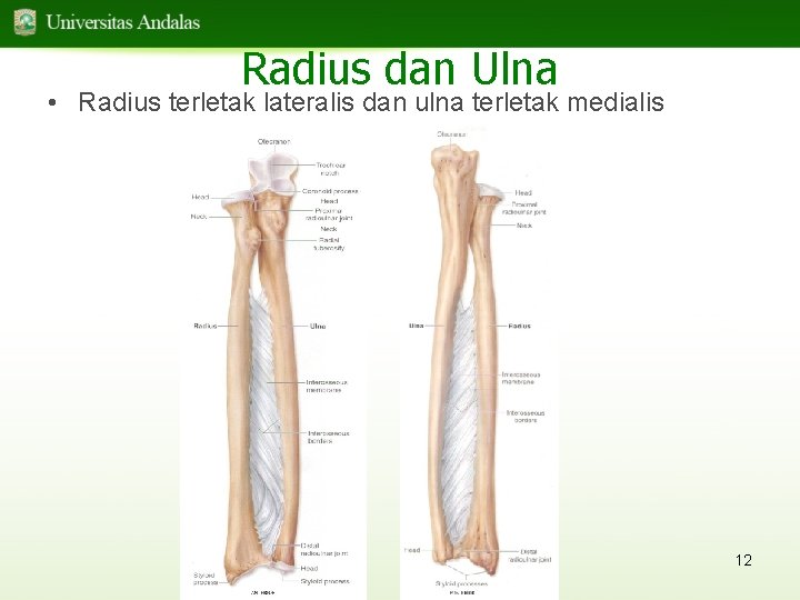 Radius dan Ulna • Radius terletak lateralis dan ulna terletak medialis 12 