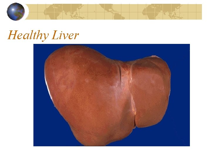 Healthy Liver 