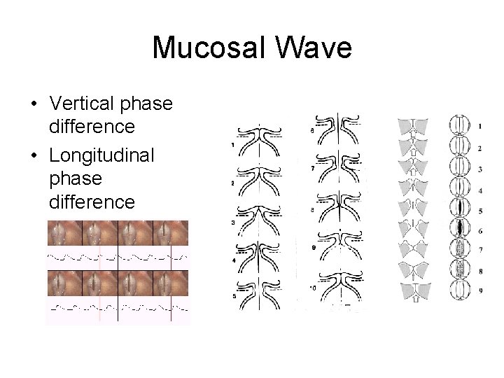 Mucosal Wave • Vertical phase difference • Longitudinal phase difference 