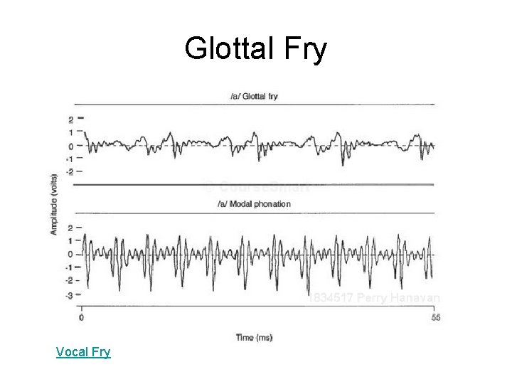 Glottal Fry Vocal Fry 