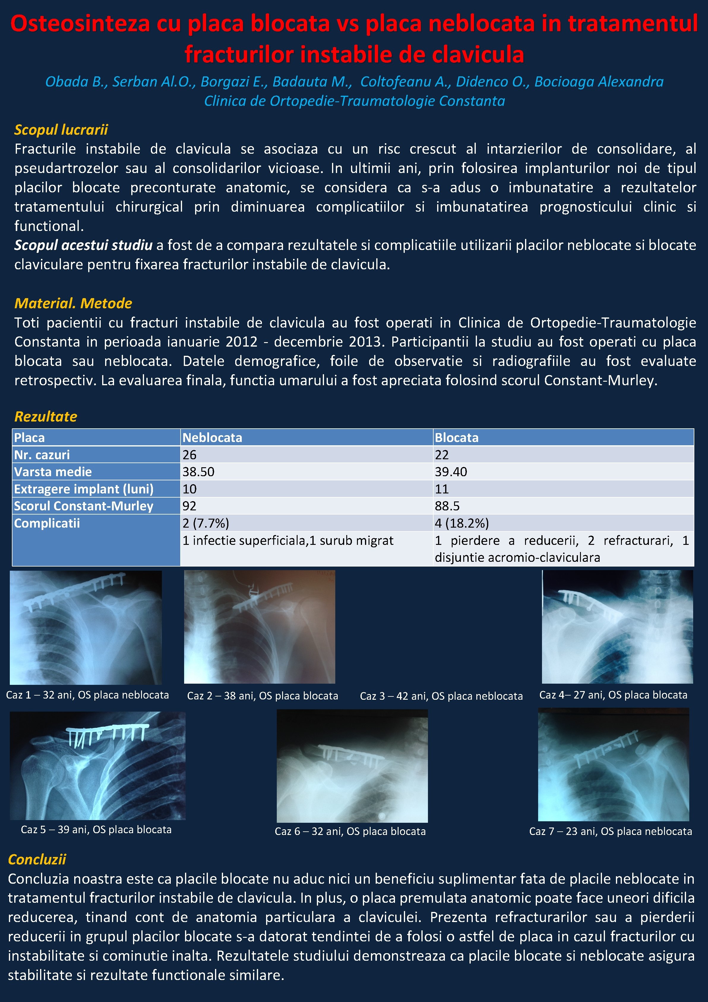 Osteosinteza cu placa blocata vs placa neblocata in tratamentul fracturilor instabile de clavicula Obada