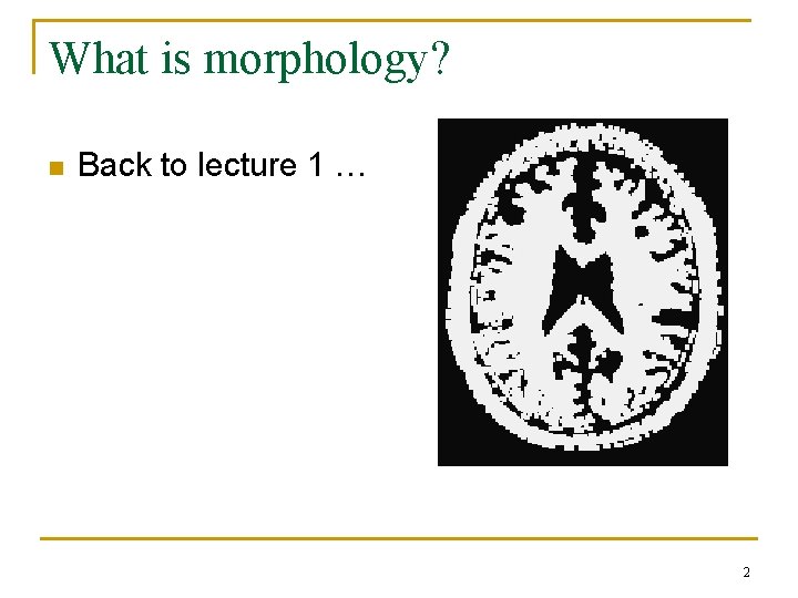 What is morphology? n Back to lecture 1 … Erosion Dilation 2 What is morphology? n Back to lecture 1 … Erosion Dilation 2