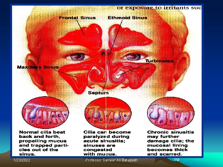 1/23/2022 Professor Sameer Ali Bafaqeeh 10 