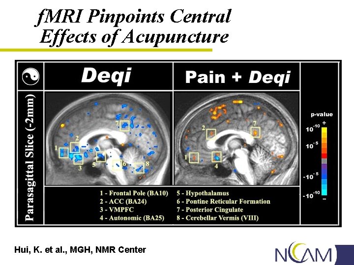 f. MRI Pinpoints Central Effects of Acupuncture Hui, K. et al. , MGH, NMR