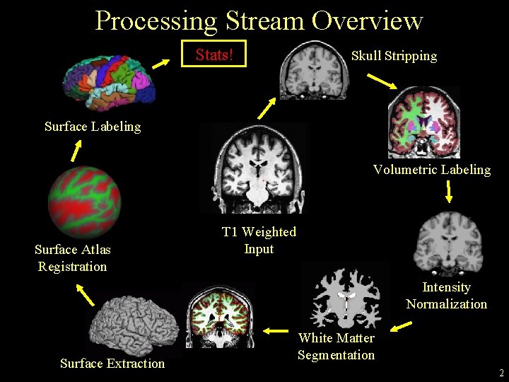 Processing Stream Overview Stats! Skull Stripping Surface Labeling Volumetric Labeling Surface Atlas Registration T