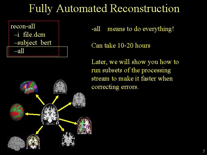Fully Automated Reconstruction recon-all –i file. dcm –subject bert –all -all means to do